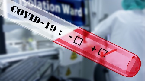 Регистровано 69 случајева короне Регистровано 69 случајева короне