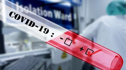 У Србији преминуло 17 особа, 2.548 новозаражених У Србији преминуло 17 особа, 2.548 новозаражених