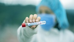 Регистрован 181 нови случај коронавируса