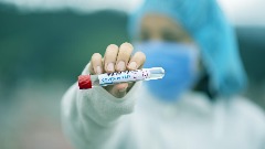 ИЈЗ: Преминула једна особа, 45 нових случајева коронавируса