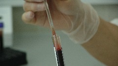 Oko 90% inficiranih krije svoj HIV status thumb1.jpg