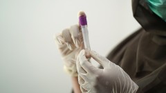 Bez slučajeva HMPV virusa ali raste broj oboljelih od slične respiratorne infekcije  thumb1.jpg