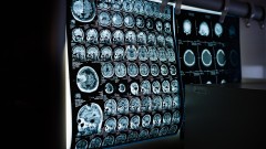 Stručnjaci došli do tajne zašto mozgovi nekih ljudi ne stare thumb1.jpg