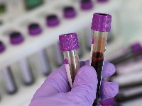Jedna krvna grupa otpornija je na kovid laboratory-38277361280.jpg