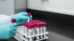 U ljudskoj krvi pronađena mikroplastika lab-g17ce4181a1280.jpg
